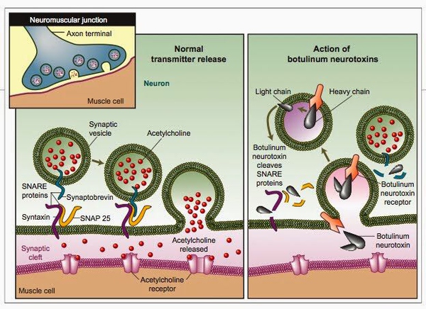 瘦腿针有没有效果有什么副作用,小腿太粗打瘦腿针有副作用吗