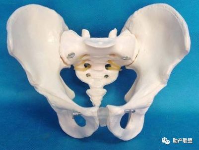 哪种情况需要侧切,分娩时侧切是什么情况