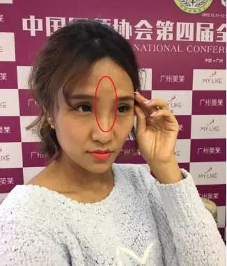 微整形黑幕大曝光,揭秘微整形认知误区