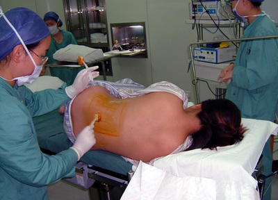 剖腹产到底有多疼，让这几位剖腹产妈妈告诉我们真相