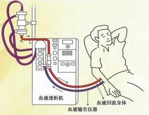 透析的副作用太可怕了,透析真的那么恐怖吗