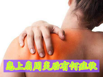 患上肩周炎后有何症状表现出来