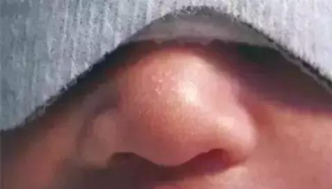 不要慌！新生宝宝这21种情况不是病！「爱贝佳月嫂讲堂」