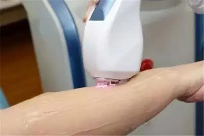 脱毛最佳时机就是现在,冬天脱毛还是夏天脱毛效果好