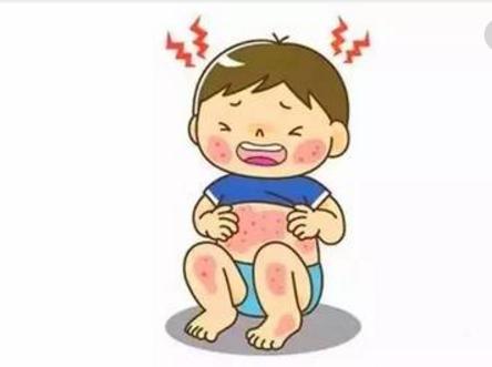 宝宝湿疹妈妈需要干预吗,湿疹宝宝妈妈怎么忌口