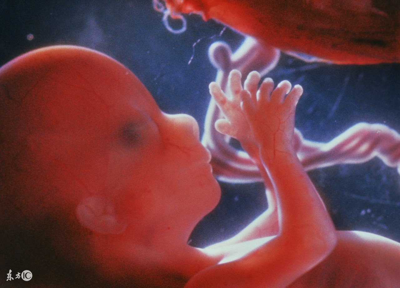 剖腹产指征——拒绝“顺转剖”