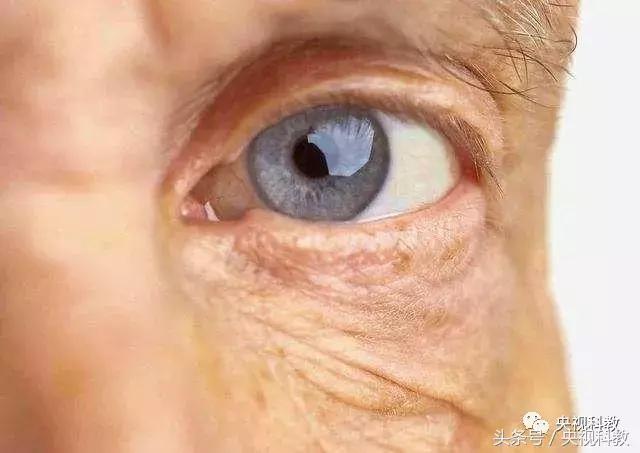 健康之路白内障的治疗,健康之路黄斑病