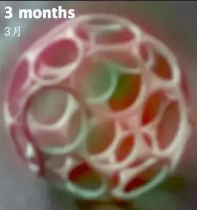 幼儿视力用视力表检查准确步骤,幼儿园孩子视力检测表准确吗