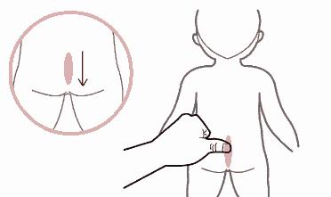 宝宝腹泻呕吐的5大原因,呕吐腹泻推拿四大手法