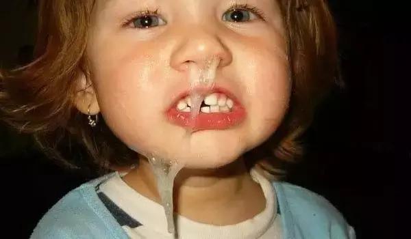 宝宝感冒去痰方法,宝宝咳嗽怎么办一招搞定