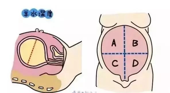 月安馨小课堂“羊水”为什么叫羊水呢？