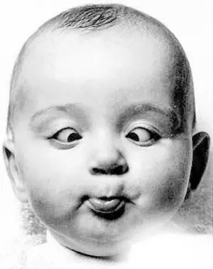 刚满1个月宝宝斗鸡眼,宝宝四个多月斗鸡眼