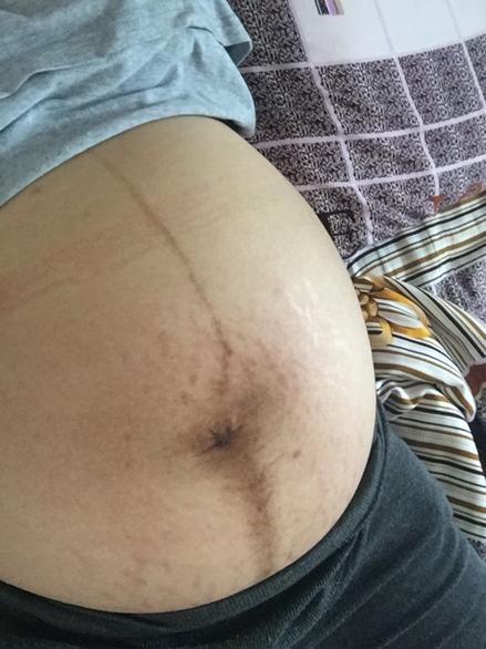 生孩子临产症状,要生宝宝前兆有哪些症状