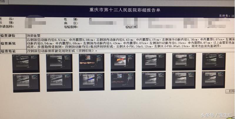 头晕夜尿多身上痒是什么原因,皮肤瘙痒是肾病的表现吗