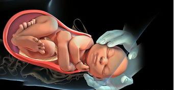 顺产对宝宝的好处与坏处,顺产对孩子的好处与坏处