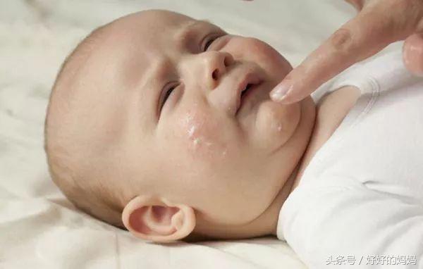 湿疹神药,被炒神药