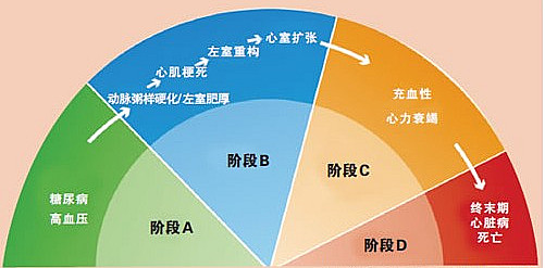 高血压患者心脏肥厚了怎么治,高血压引起的心室肥厚怎么治疗