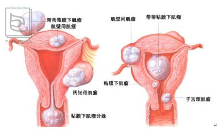 北美红宝石蔓越莓干,北美顶级红宝石蔓越莓