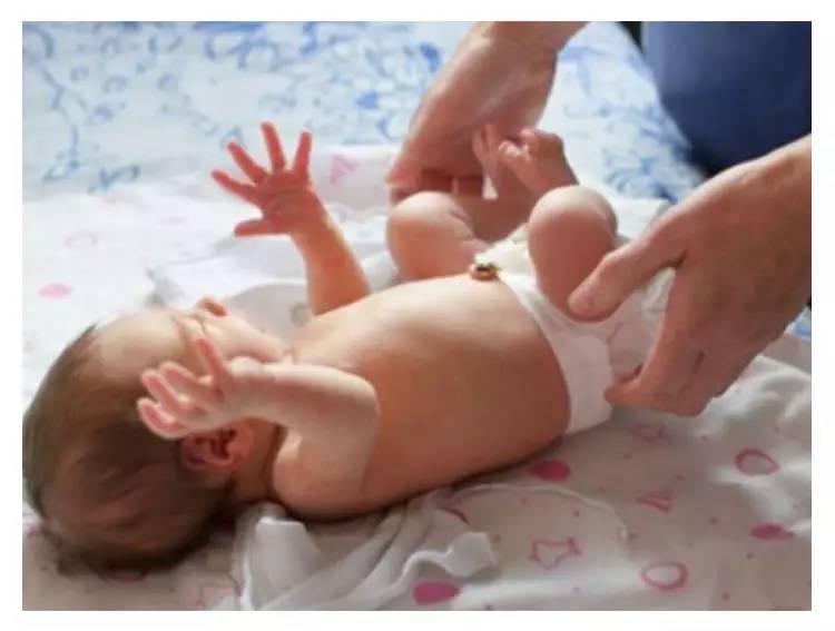 宝宝肚脐发红发臭怎么回事,宝宝肚脐发红有异味是怎么回事