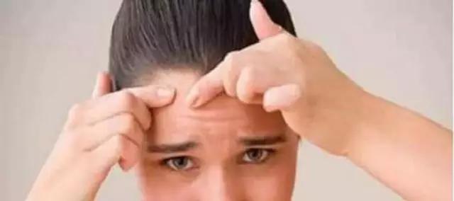 挤痘痘的正确手法图解,挤痘不留印的正确方法