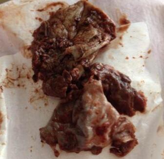 纳尼!产后这么恶心的东西-恶露,小方法搞定它。