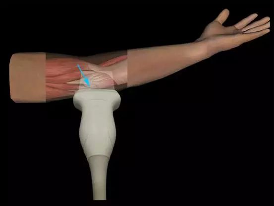 超声提示不发育了怎么回事呢,超声检查不硬咋办