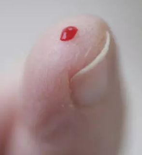 宝宝受伤消毒用酒精还是碘伏,宝宝摔伤了用碘伏消毒的正确方法