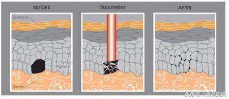 春节变美护肤,开学突击变美