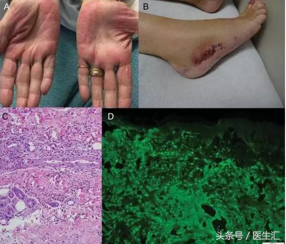 末梢神经病变有哪些症状,神经末梢病变的主要症状