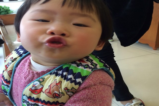 宝宝冬天手长冻疮,宝宝冻疮的原因及治疗方法