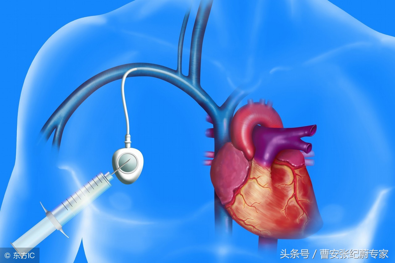 婴幼儿血管瘤常见的治疗方法,婴幼儿血管瘤的治疗方法