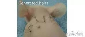 日本研究秃顶,日本教授秃头研究