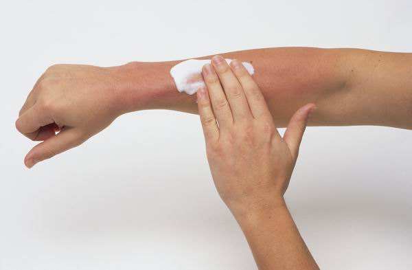 脂溢性皮炎能吃木耳吗,吃木耳会加重皮肤病吗