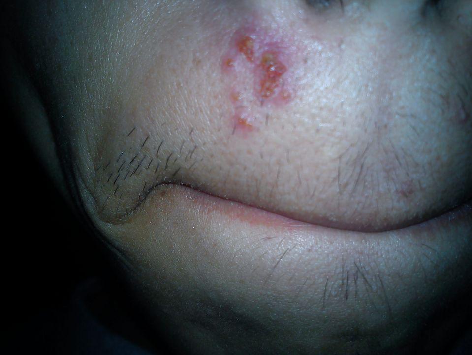 流感好了感觉不快乐,流感好了不想吃饭