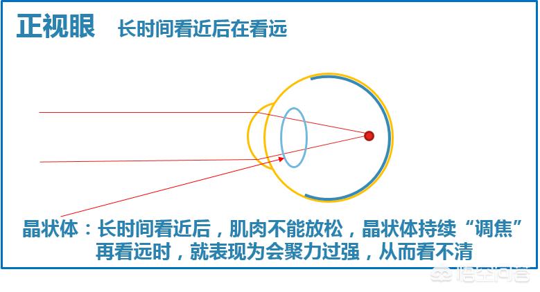 晚上如何远眺防近视,为什么远眺有助于预防近视