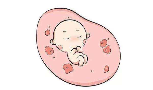 胎儿早产很危险，引起早产的五大原因，孕妈不可忽视