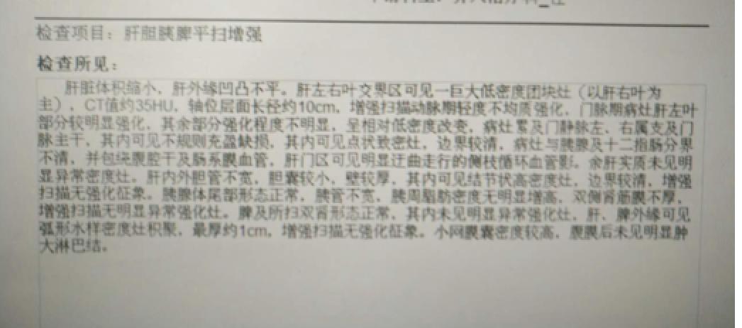 肝癌病例实例100例,肝癌的治疗方法论文