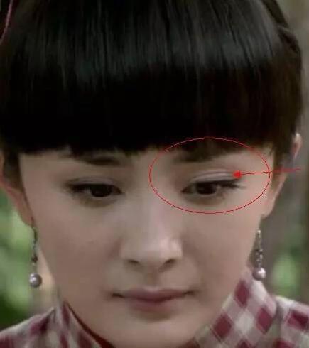 女明星都用双眼皮贴,为什么女明星用双眼皮贴