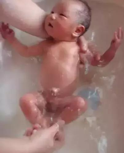 月嫂分享：新生儿肚脐5个异常要注意！