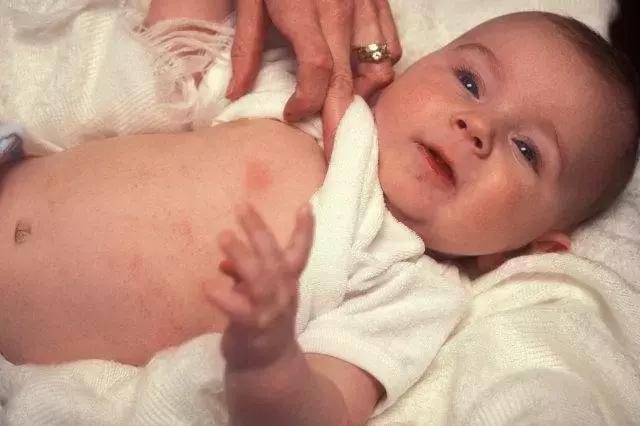 宝宝对净水器水过敏,对水过敏宝宝