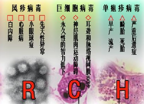 准妈妈这些小病可能会引起胎儿“大病”