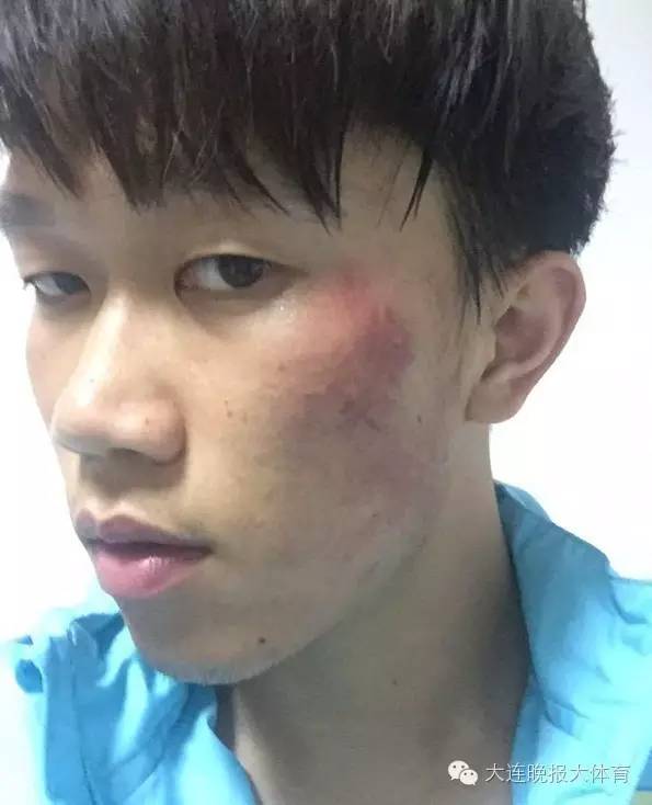 足协杯苏宁遭业余球队罕见*攻围**，武汉宏兴表示打人者一律开除！