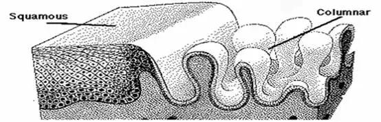 宫颈糜烂看病被医院骗怎么办,宫颈糜烂是智商税