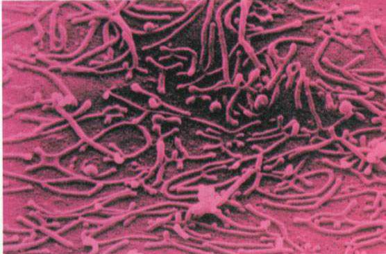 妇科支原体阳性影响怀孕吗,男性支原体阳性能怀孕吗