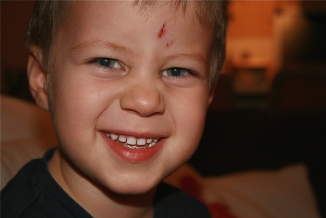 八种意外伤害的急救方法,儿童意外伤害事故预防和急救知识