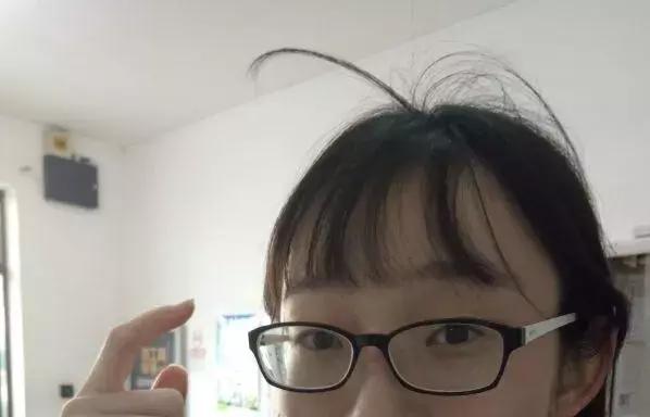 现实中真的有所谓的呆毛吗,呆毛在现实中真的会有吗