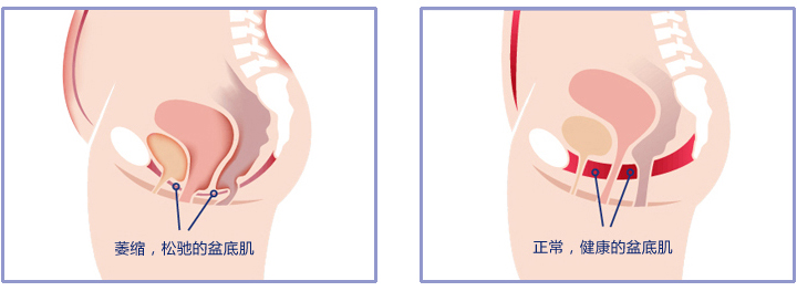 盆底肌和尿道括约肌的关系3d图解,盆底肌知识全解
