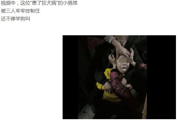 真人真事得狂犬病20天后学狗叫,视频里狂犬病发作学狗叫是真的吗