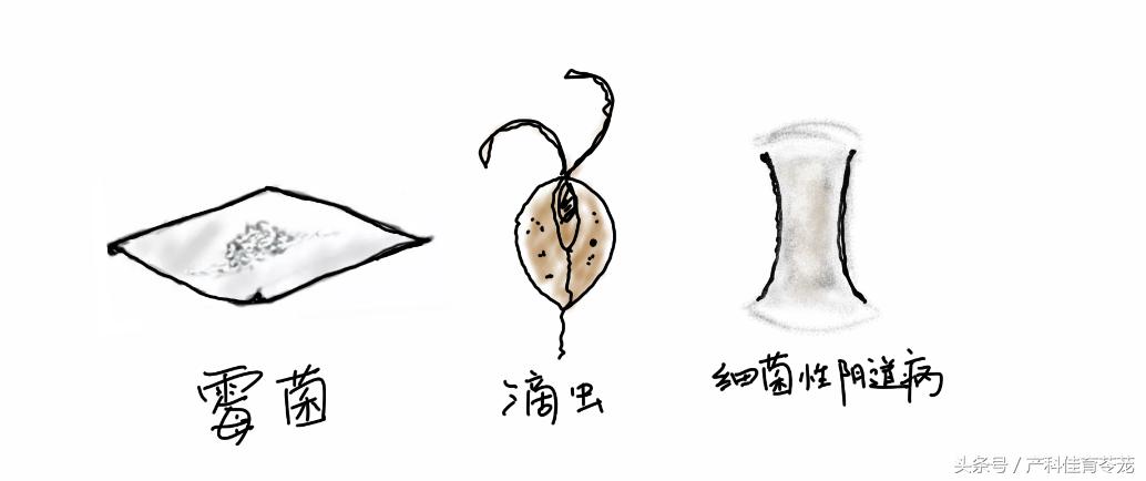 外阴瘙痒骚味重用什么药,外阴瘙痒可以自愈吗