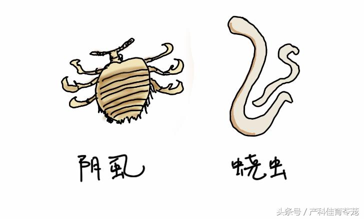 顽固性外阴瘙痒治不好了吧,不明原因的外阴瘙痒怎么办